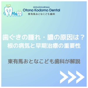 東有馬 歯ぐき 腫れ 膿 根の病気 根管治療の原因と早期治療の重要性 おとなこども歯科
